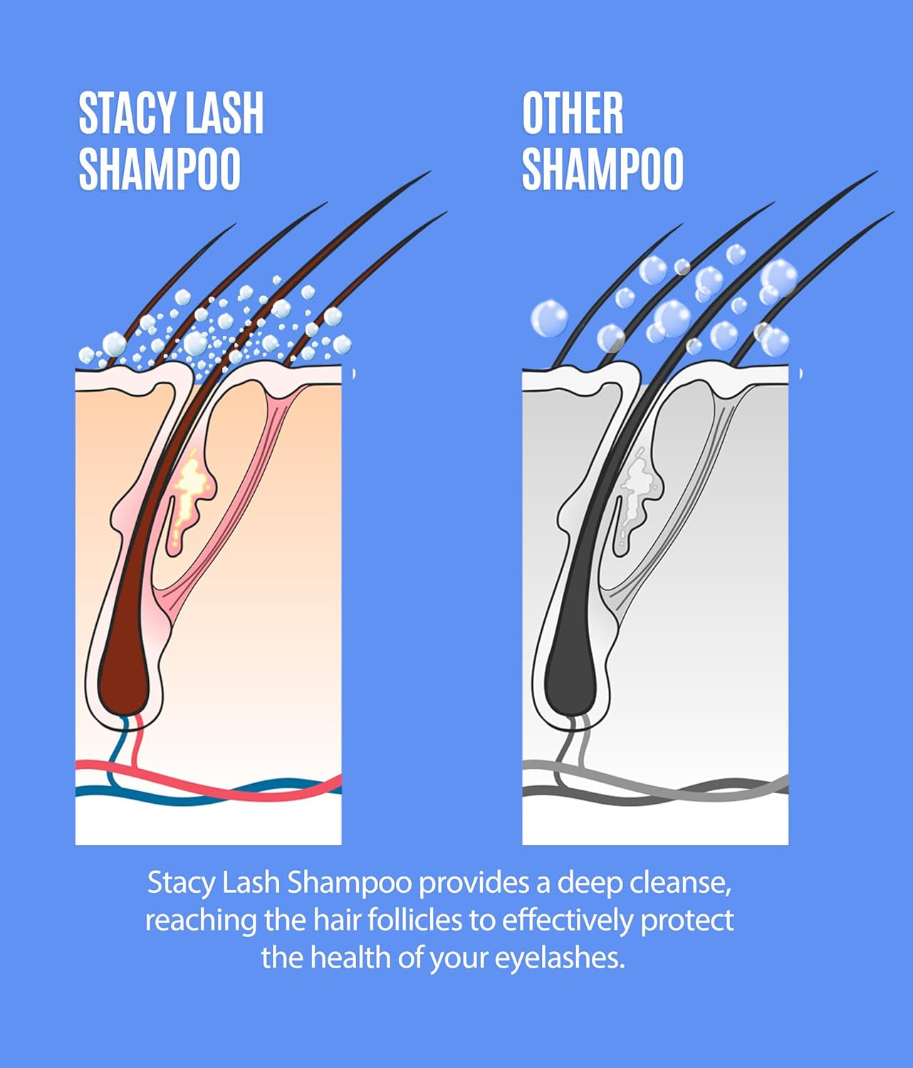 Lash Shampoo 100Ml+ Eyelash Growth Serum by / /Cleaning Kit of Eye Makeup Remover (Cleanser) + Brush & Eyelash Serum for Eyelash Growth and Thickness
